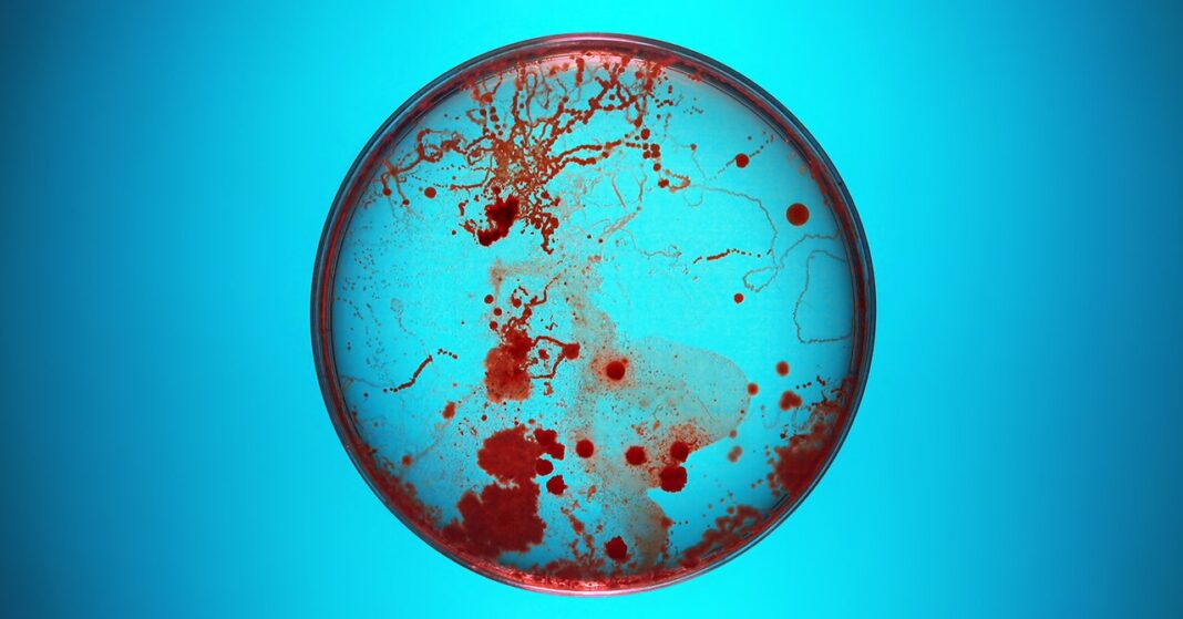 Bacterial cultures growing on a petri dish