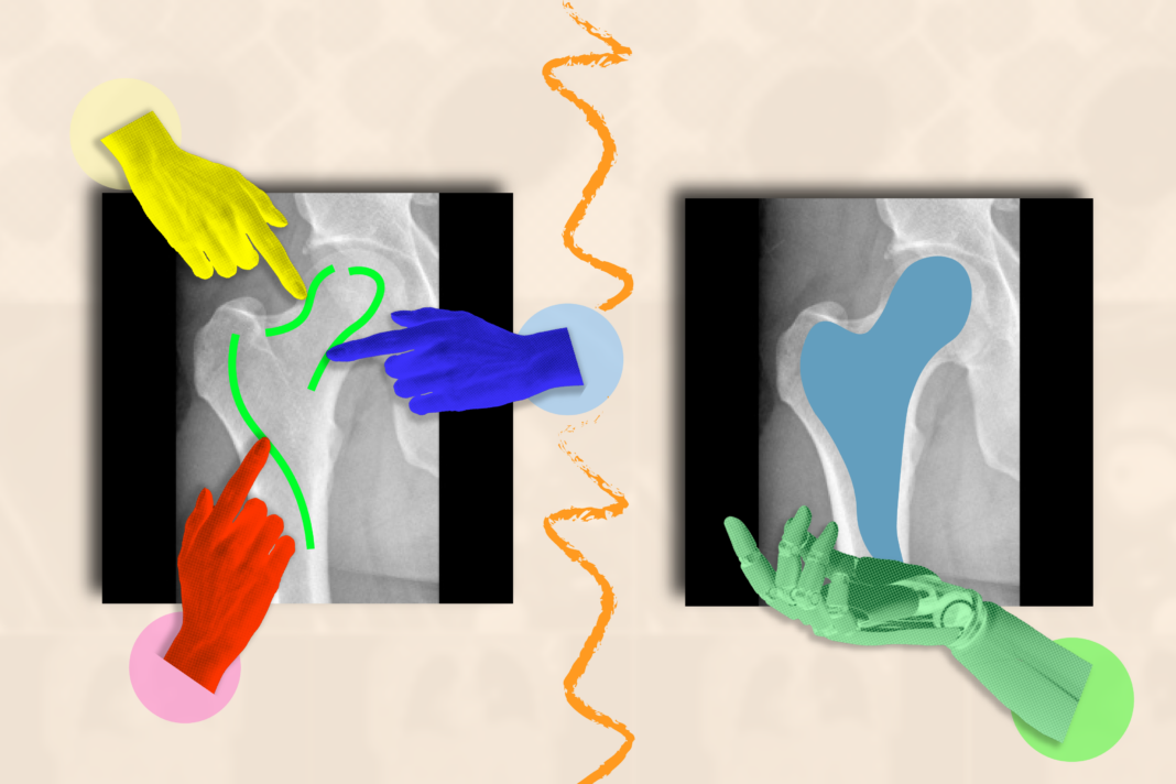 Abstract hip X-rays with colorful overlay graphics.